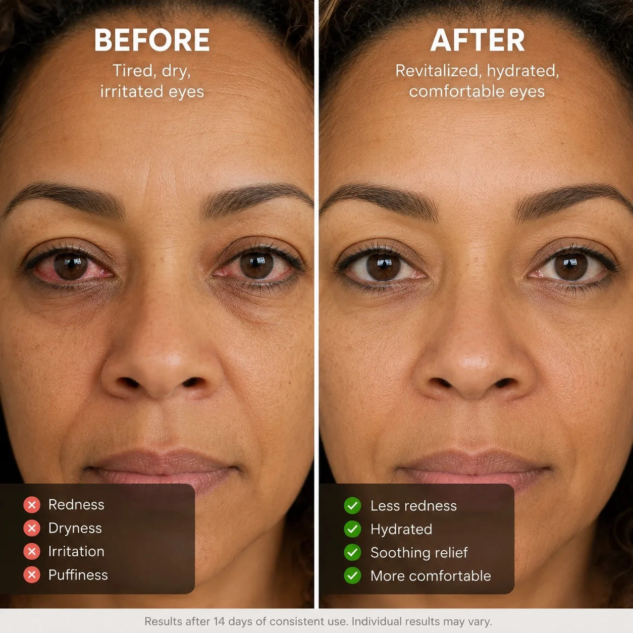 Eye steam therapy pro