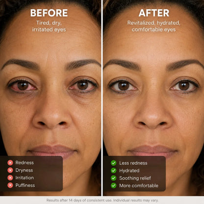 Eye steam therapy pro